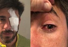 “No voy a jugar en una cancha donde puedo morir” “No voy a jugar en una cancha donde puedo morir”