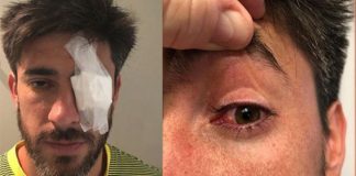 “No voy a jugar en una cancha donde puedo morir” “No voy a jugar en una cancha donde puedo morir”