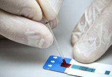 Escobarenses podrán realizarse un test gratuito para detección de VIH