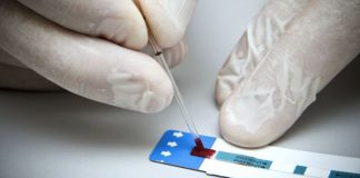 Escobarenses podrán realizarse un test gratuito para detección de VIH