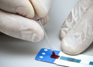 Escobarenses podrán realizarse un test gratuito para detección de VIH