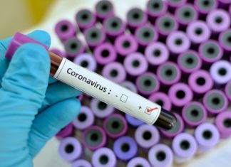 Nuevas medidas por el coronavirus: Licencias, trámites y plazas