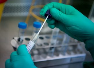 Escobar suma cinco nuevos casos de coronavirus