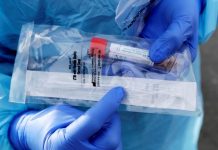 Confirmar tres nuevos casos de coronavirus en Escobar