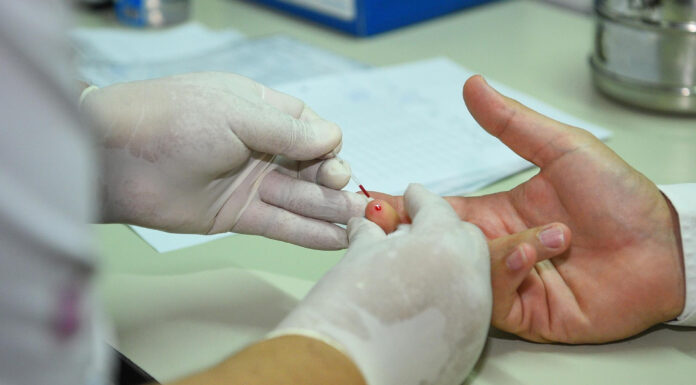 Suba de casos de sífilis: la Municipalidad de Escobar profundiza la campaña de testeos y prevención